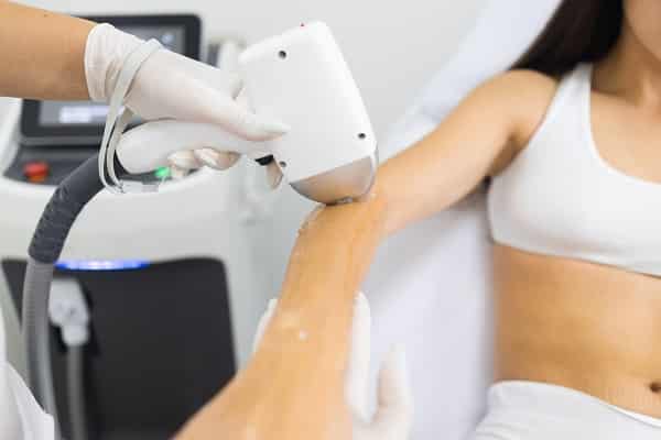 Removing Body Hair Chemically