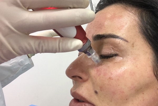 Beauty Treatments