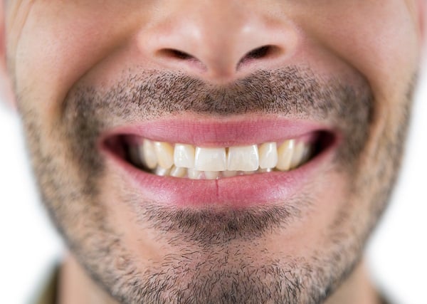 Teeth Whitening