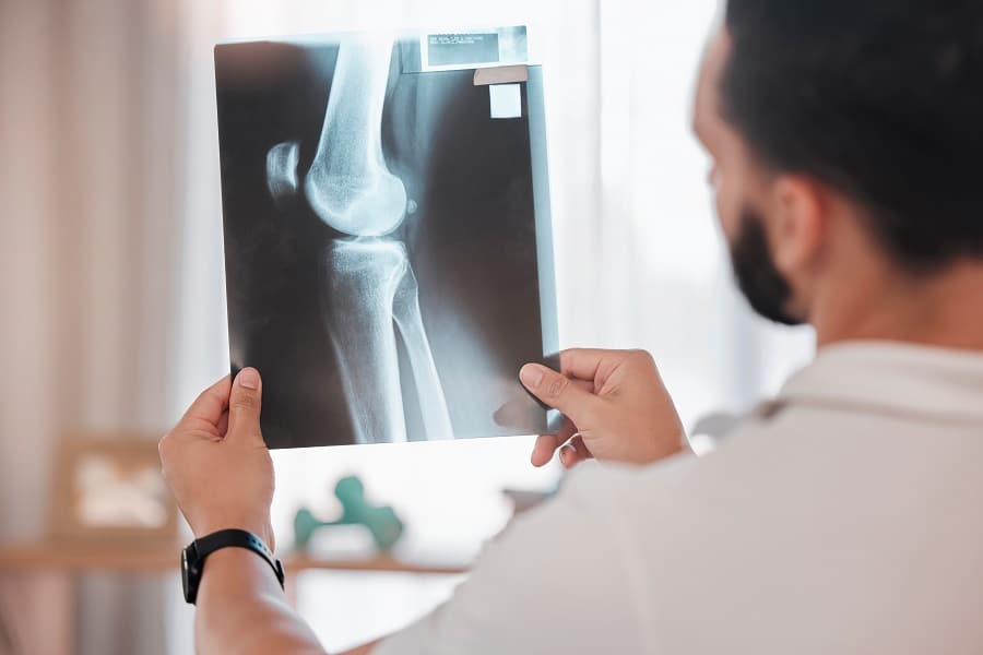 Bone Health